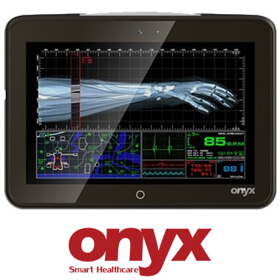 Onyx MD116 11.6"