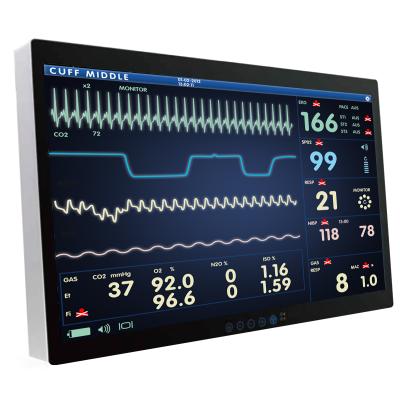 Onyx ACCEL Panel PC 32&rdquo; 4K UHD Smart View AMD Ryzen Embedded V1000 Multi-Touch